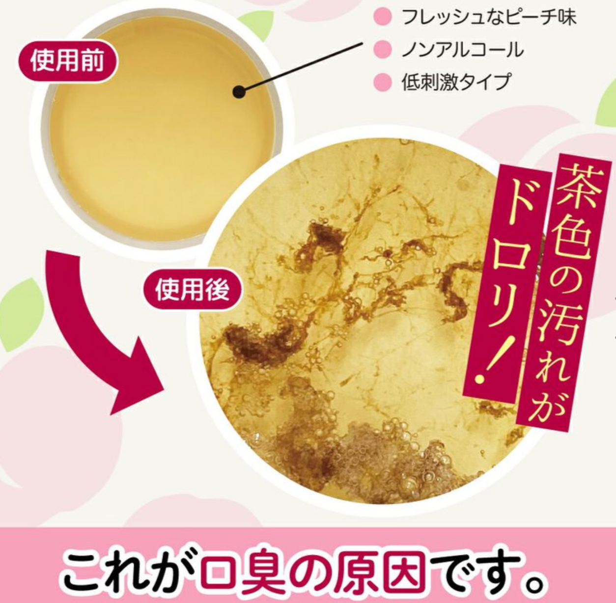 🇯🇵🤭👄Techxcels Okuchi 휴대용 구강청결제 5포 세트 (피치/체리/라임민트/레몬)//Techxcels Okuchi Portable Mouthwash 5-Pack (Peach / Cherry / Lime Mint / Lemon)