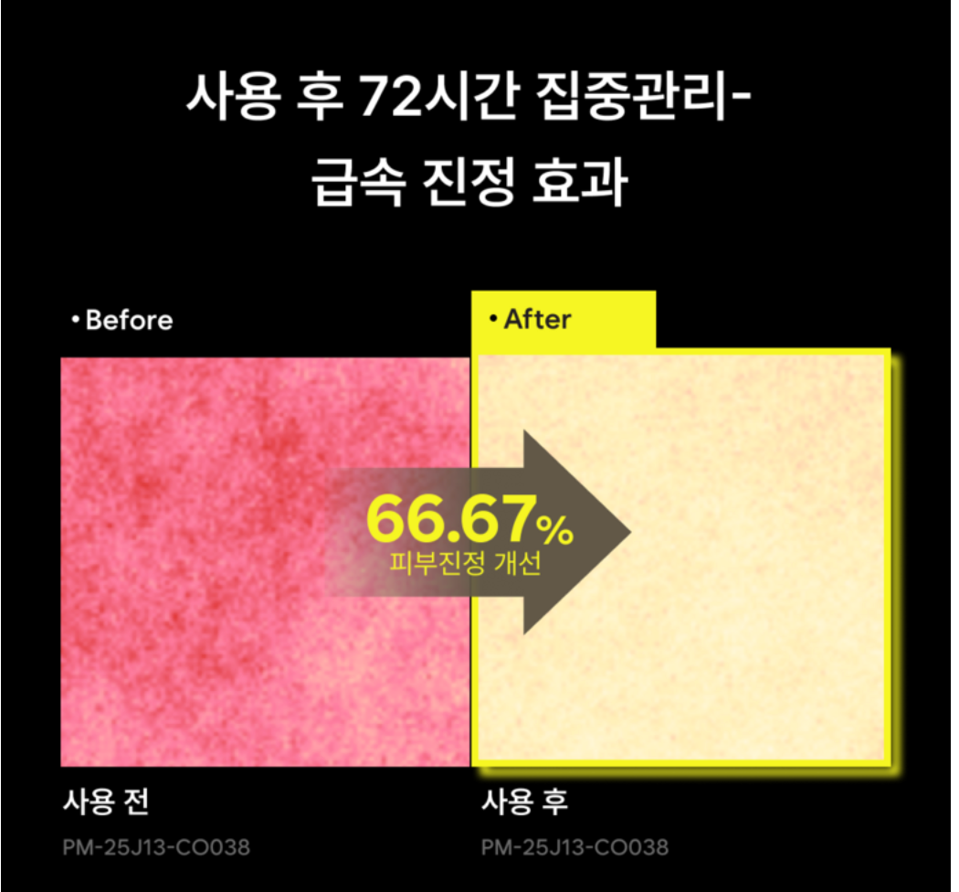 🔥[레이저&여드름 재생크림][한국약국 대란템][닥터유셀라] EGF+PDRN 펜타비틴 이펙트 부스터 리페어 크림 50g / Dr.Ucella EGF+PDRN Pentavitin Effect Booster Repair Cream 50g