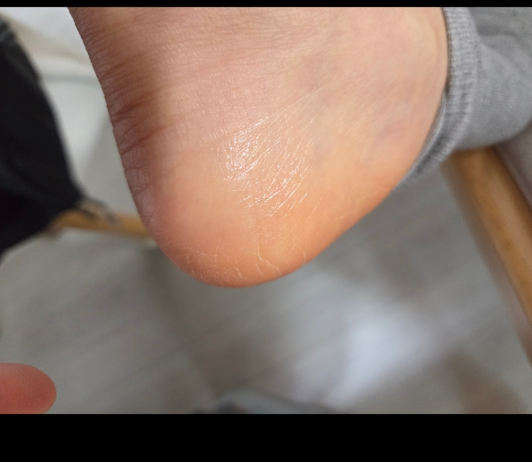 🦶🏻고운발 명품 풋크림 2 or 4개 세트 Premium Foot Care Cream Set (2 or 4 pcs) 🦶✨